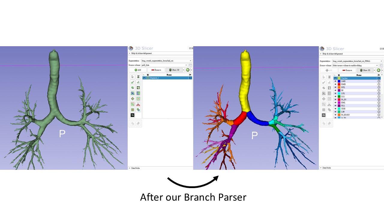 Bronchial Branch Parsing